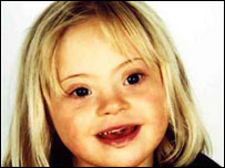 Estudo revela começo da Síndrome de Down no embrião