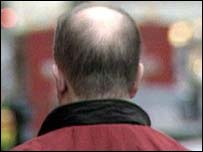 CIENTISTAS DESCOBREM NOVOS FATORES GENÉTICOS PARA CALVÍCIE